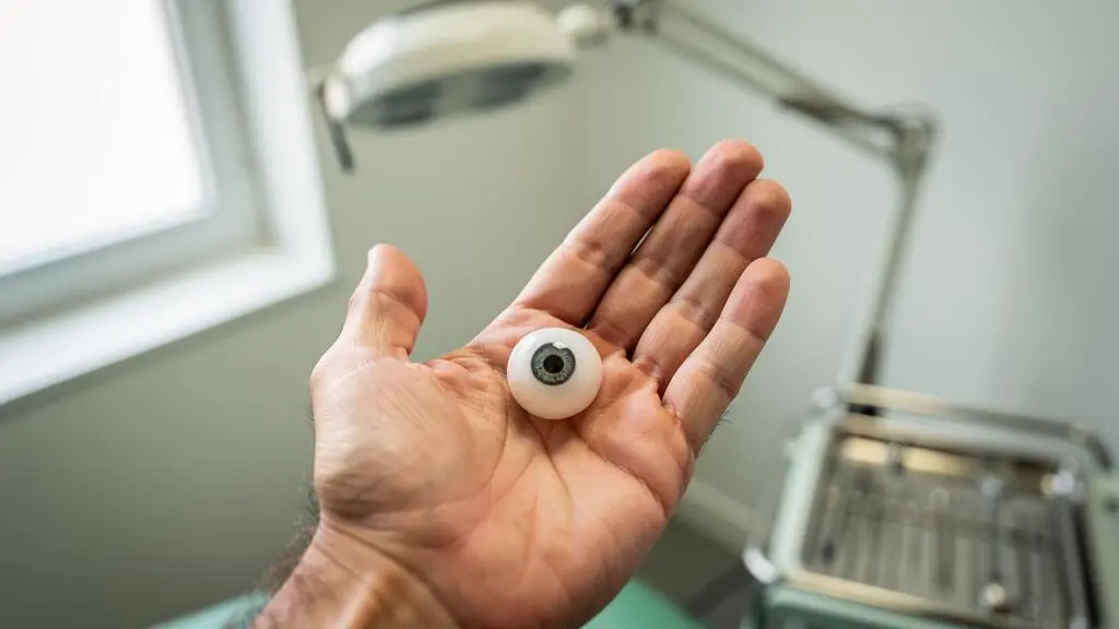 Une prothèse oculaire en verre posée dans la paume ouverte d'une main, dans un cabinet.